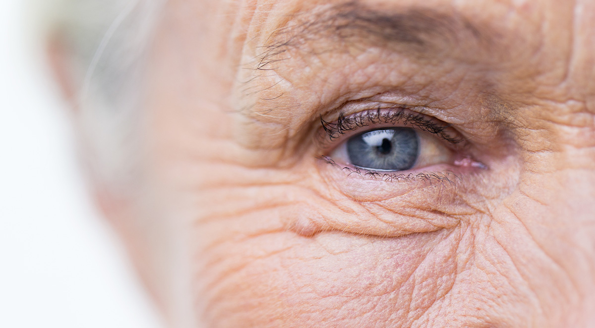 What Are The Symptoms Of Glaucoma?
